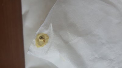 Squipper poop