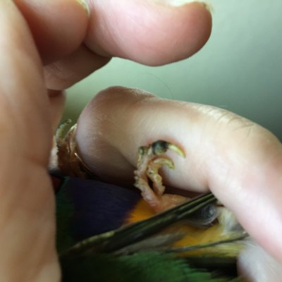another black toe.jpg